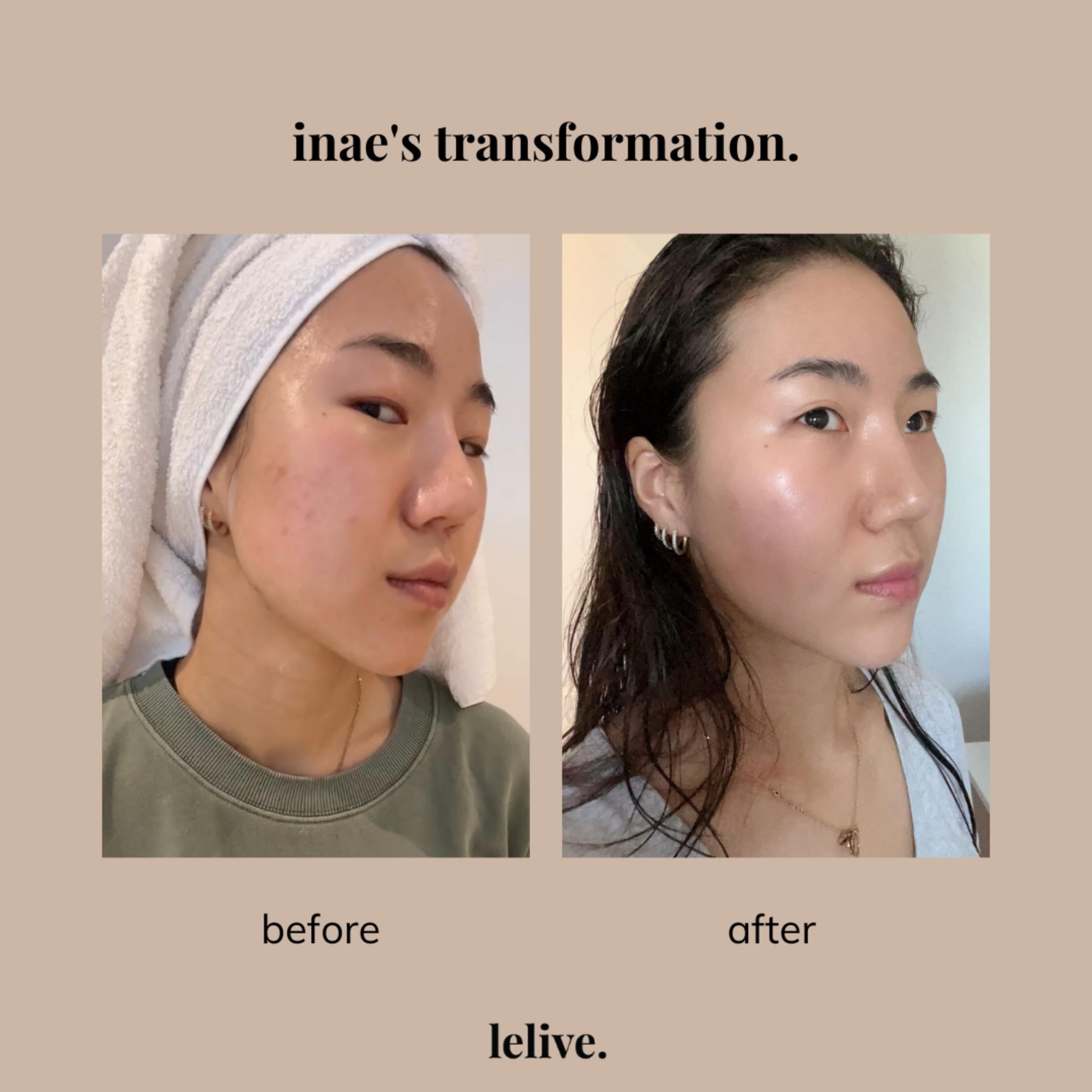 Skincare product featuring AHA and BHA for effective exfoliation and clear skin enhancement