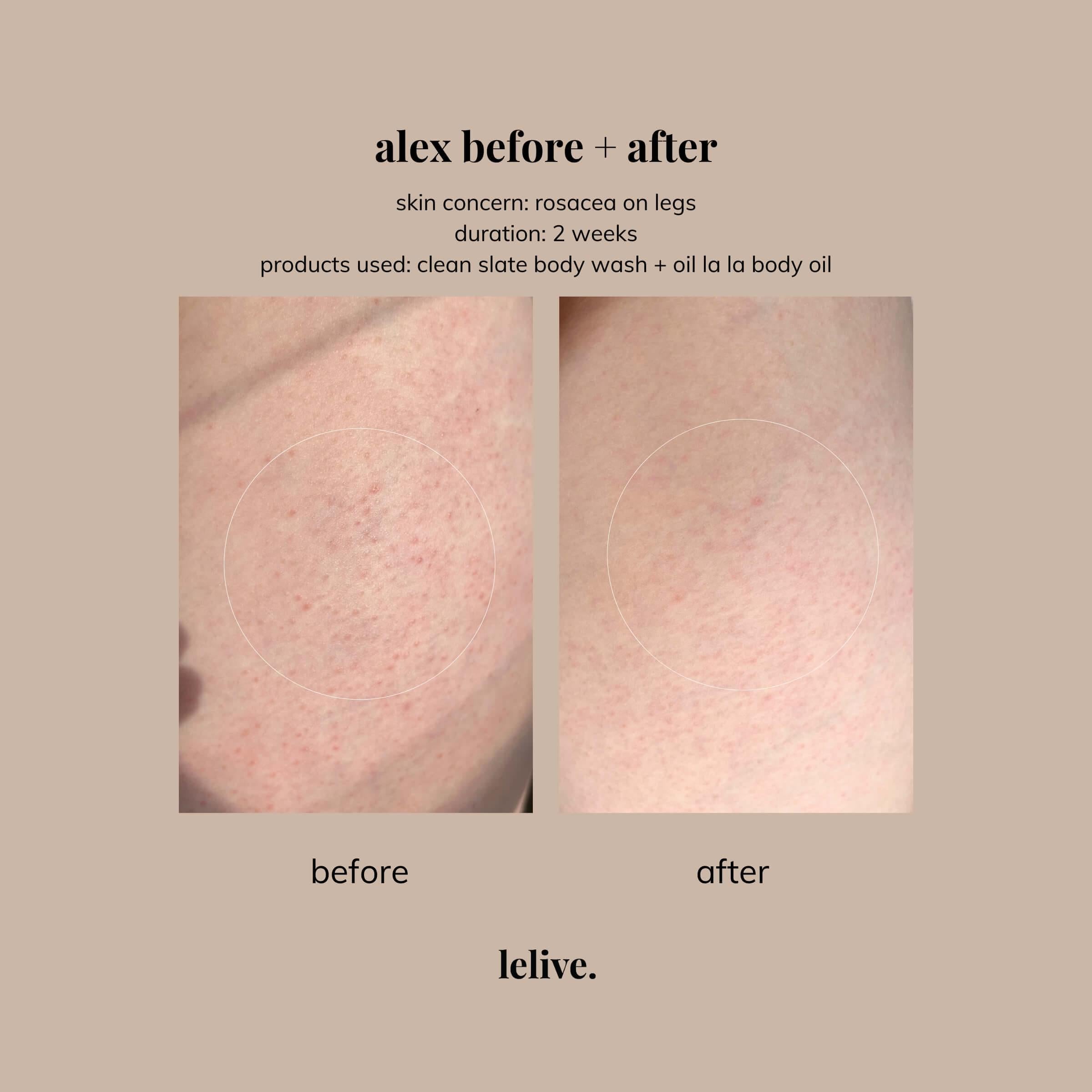 Exfoliating body wash for smooth and refreshed skin, ideal for daily cleansing and gentle exfoliation