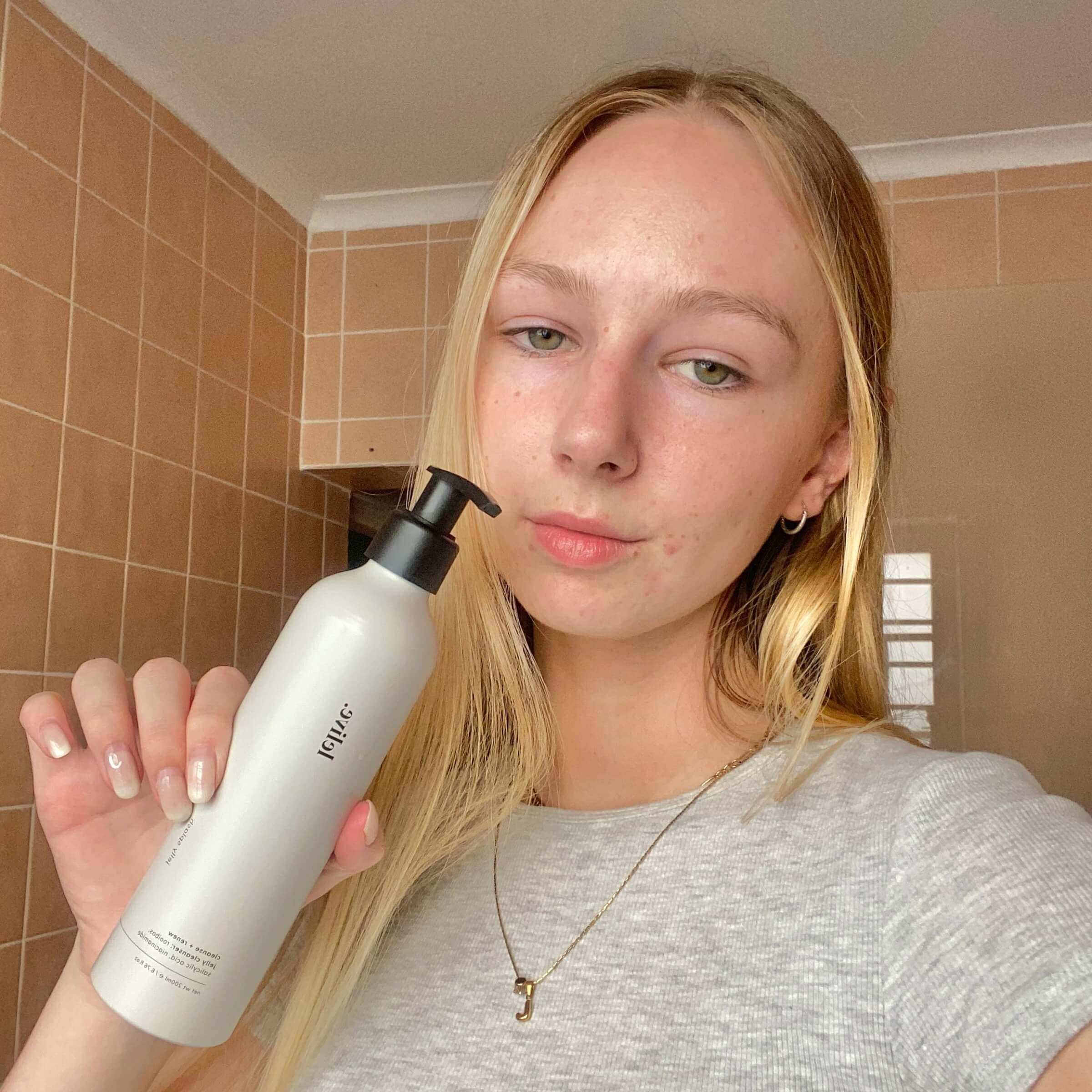 Salicylic acid treatment for effective care of acne-prone skin to reduce blemishes and improve complexion