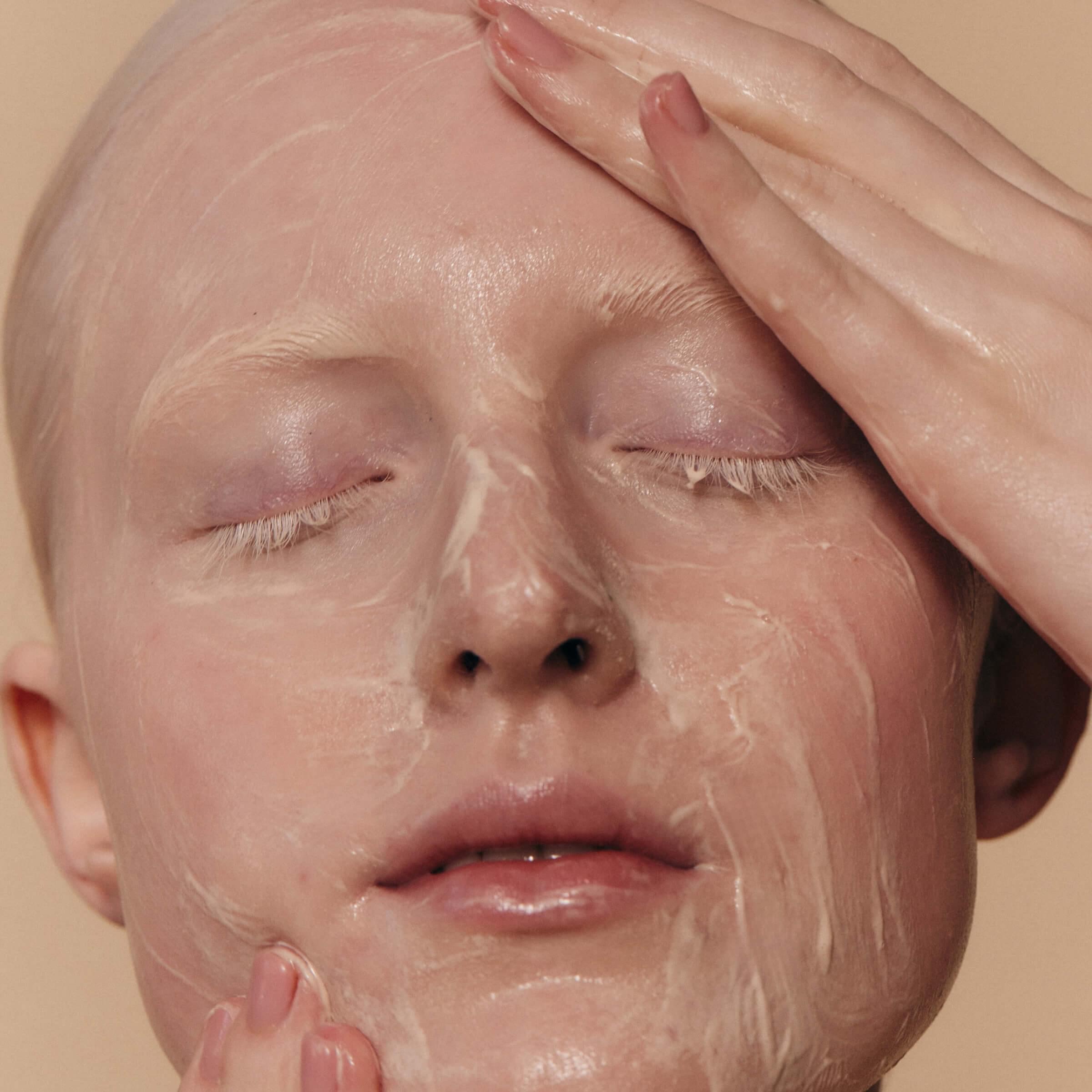 Salicylic acid treatment for effective care of acne-prone skin to reduce blemishes and improve complexion