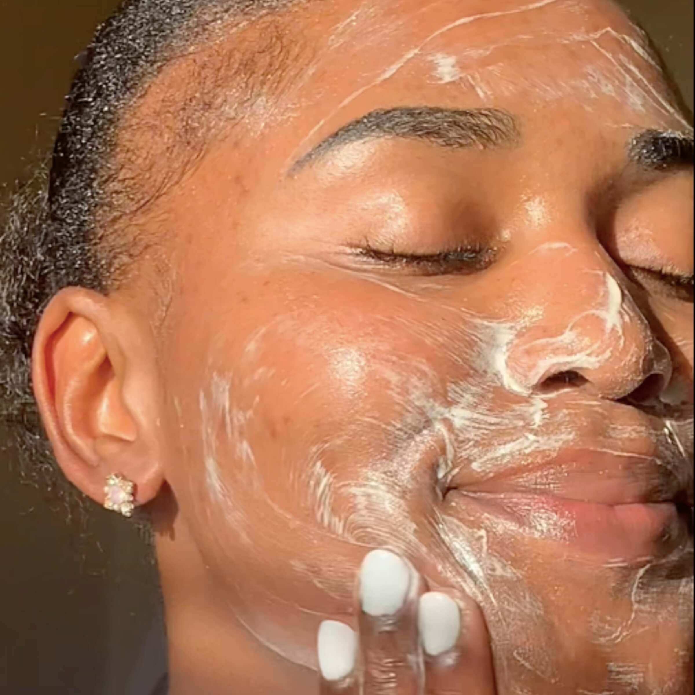 Salicylic acid treatment for effective care of acne-prone skin to reduce blemishes and improve complexion
