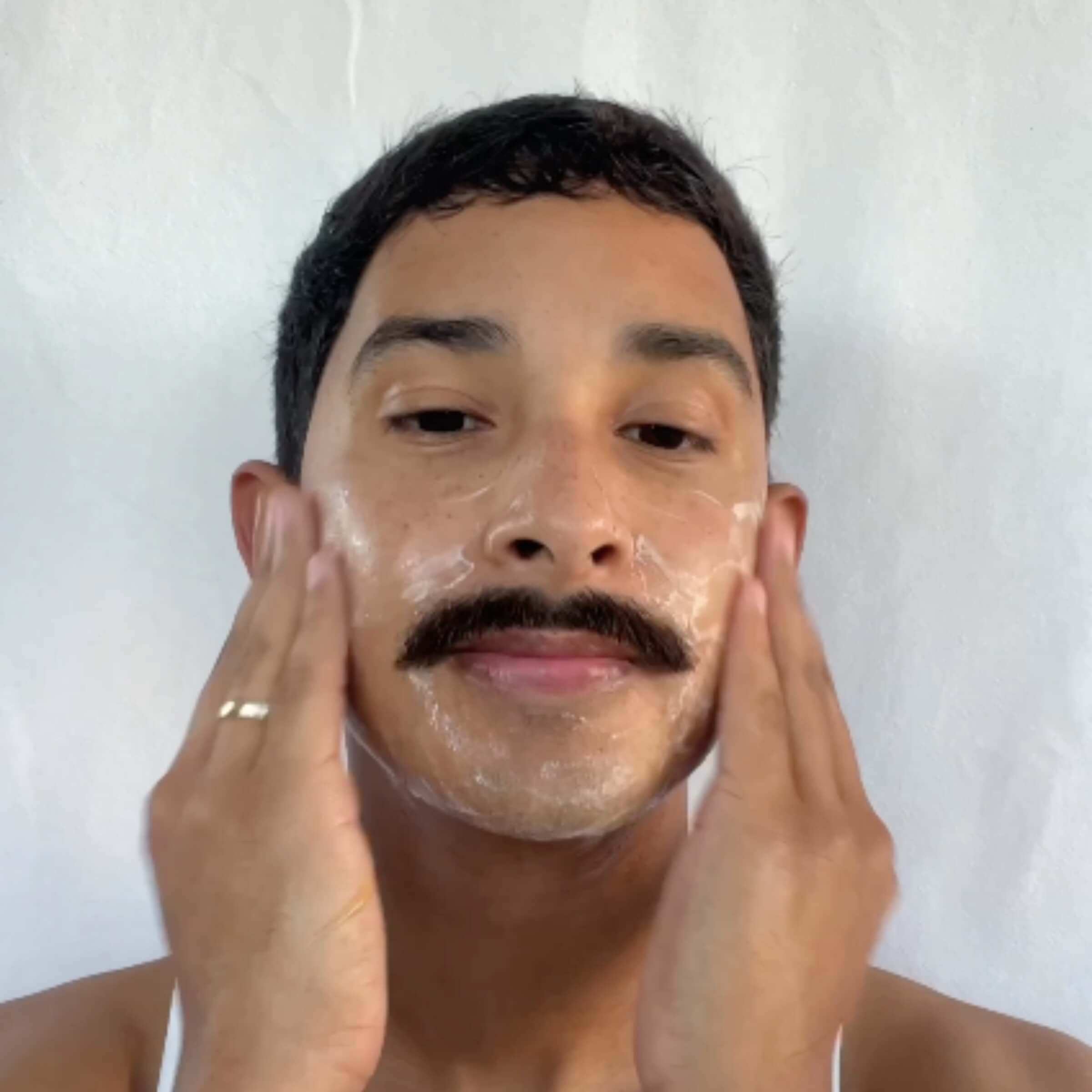 Salicylic acid treatment for effective care of acne-prone skin to reduce blemishes and improve complexion